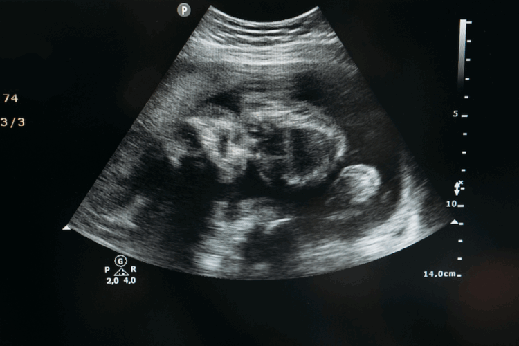 David Levin, Comedy Blog, Top 10 List, Top 10 Joke List, List, Funny One Liners, Sperm Egg Jokes, Sperm Swimmer Jokes, Conception Jokes, Pregnancy Jokes, Circumcision Jokes, Baby Jokes, Toddler Jokes, New Parent Jokes, Foreskin Jokes, Bris Jokes, Politically Incorrect Jokes, Non PC Jokes, Comedy Writing Help, Joke Writing Help, Hire Top 10 Joke Writers, Best Jokes, Funny Articles, Funny Blog, Funny, Improv, Stand-Up Comedy